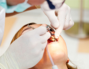 歯周外科手術（フラップ手術）